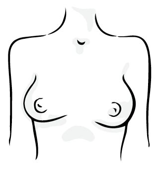 Asymmetrical breasts shape