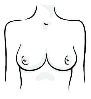 Tear drop breasts shape